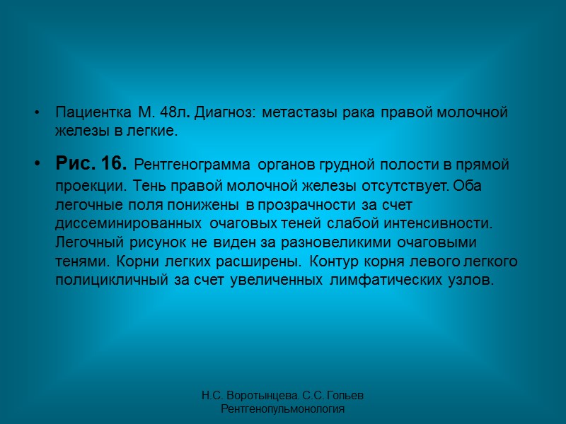 Н.С. Воротынцева. С.С. Гольев  Рентгенопульмонология Рис. 3в