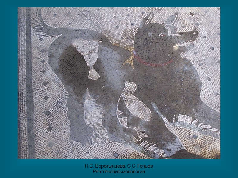 Н.С. Воротынцева. С.С. Гольев  Рентгенопульмонология Флоренция