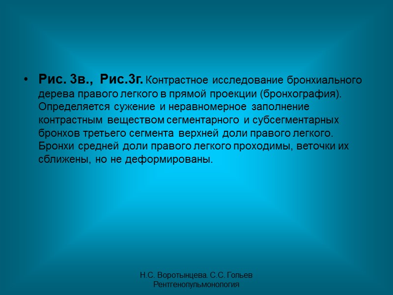 Н.С. Воротынцева. С.С. Гольев  Рентгенопульмонология
