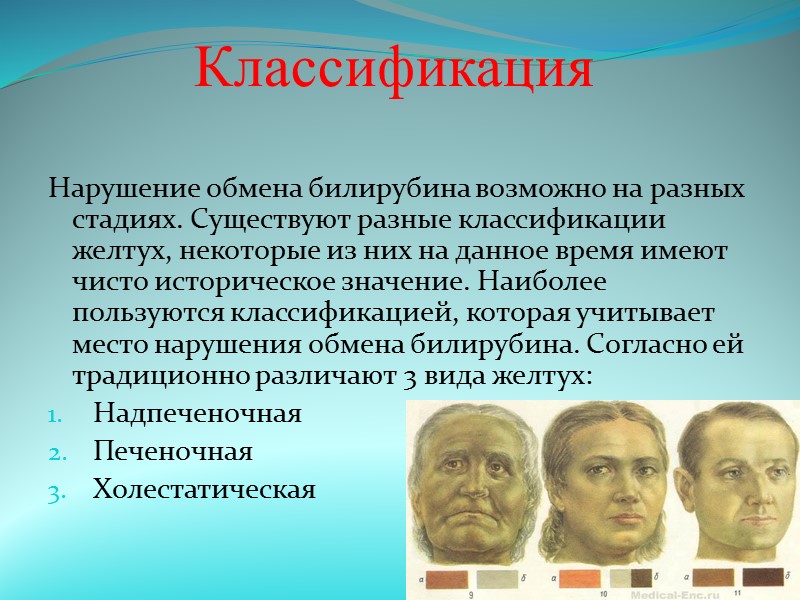 14. Бактериальная пневмония. Клиника: при тяжелом течении, особенно в случаях крупозной пневмонии, возможна умеренная