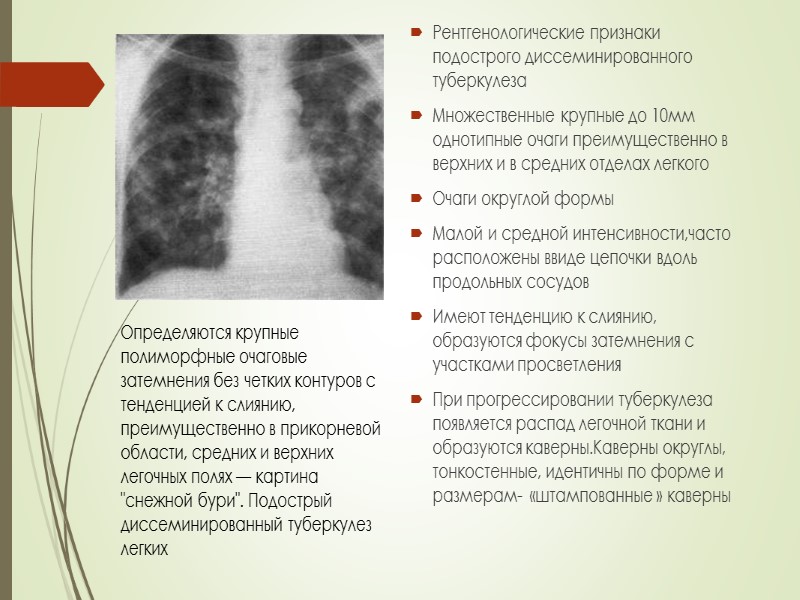 5.Для хронического диссеминированного туберкулеза характерна рентгенологическая картина:  а) мелкие однотипные очаги, расположенные верхних