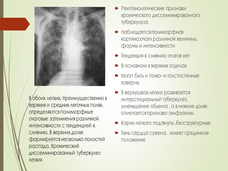 7. Развитие диссеминированного туберкулёза лёгких чаще всего    сочетается с поражением: а)