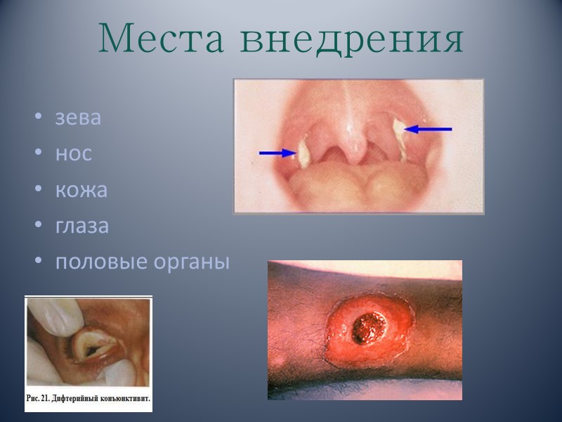 Места внедрения  зева нос кожа глаза половые органы