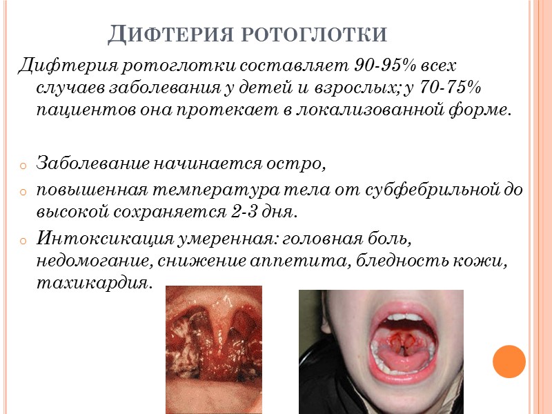 За 1980 - 1995 гг. в Украине переболело дифтерией 14690 человек (из них детей