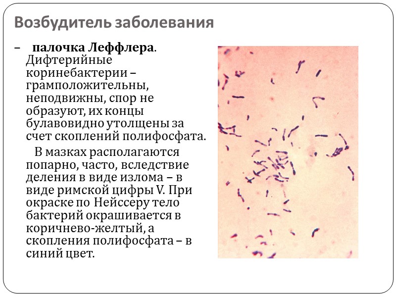 Формы дифтерии.    По локализации – дифтерия глотки, носа, гортани, дыхательных путей