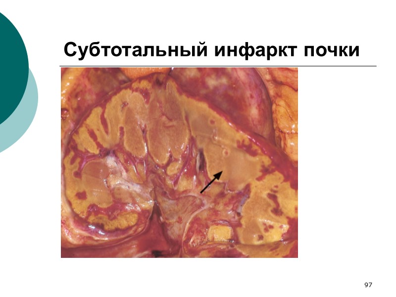 114 разрушение  клетки  происходит  с  участием  специальных  кальций-магний-зависимых