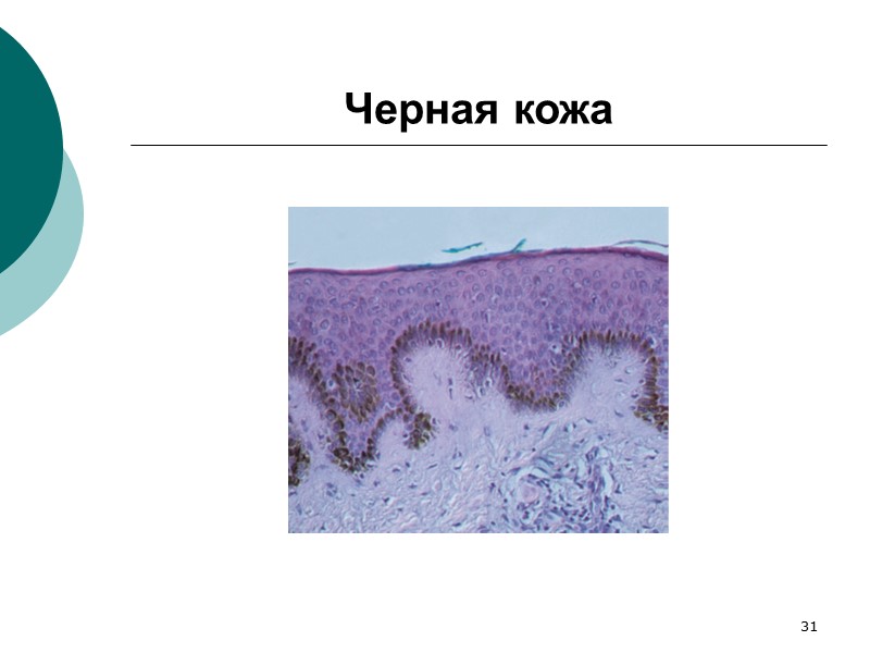 42 Морфогенез гипермеланоза при Аддисоновой болезни Усиление синтеза АКТГ в ответ на снижение продукции
