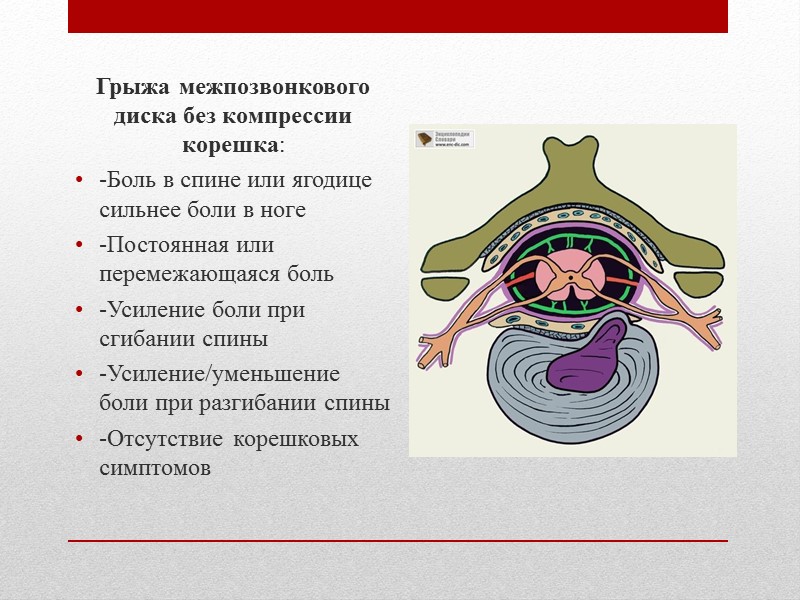 Классификация боли по течению  Острая боль < 6 недель Подострая боль 6 –12