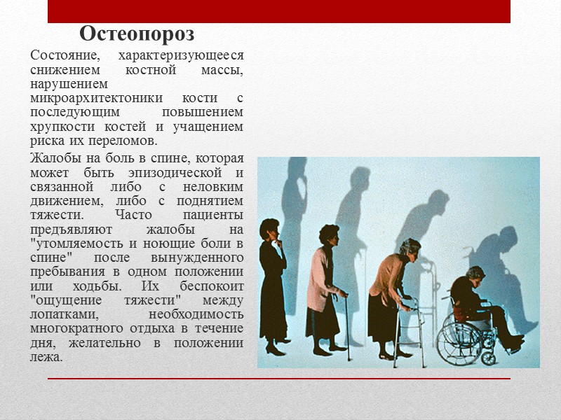 Фибромиалгия  Фибромиалгию следует рассматривать как отдельную нозологическую форму с первичным поражением мышц. 