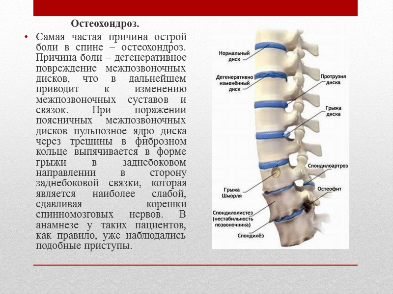 Боли в спине (поиск причины)  Анамнез Общий осмотр Неврологический осмотр Лабораторная диагностика Визуализация