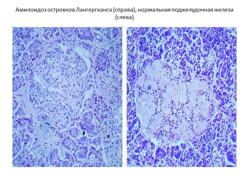 Рисунки по патологической анатомии