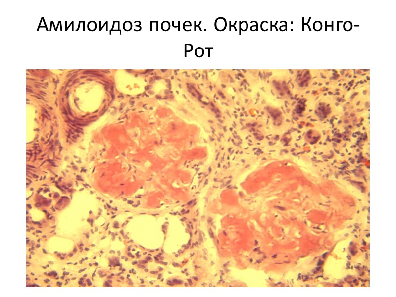 3. Липофусцин не повреждает клетки и не снижает их функции  4. Накапливается при…