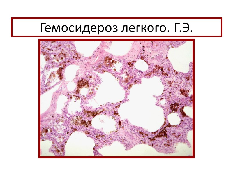 Патанатомия в схемах и таблицах благодаров