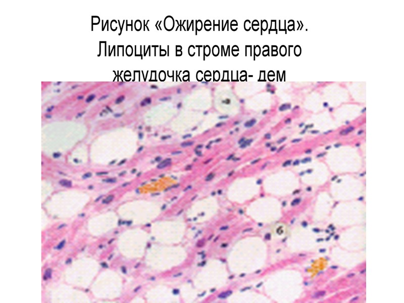 Липоциты. Паренхиматозные клетки. Паренхиматозная ткань. Стромальные и паренхиматозные клетки это. Ожирение сердца у собаки.