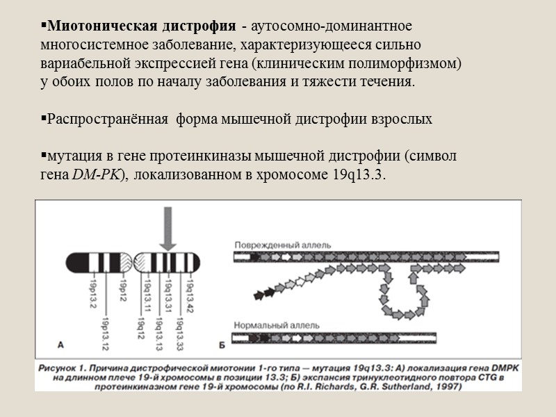 Миотоническая дистрофия презентация