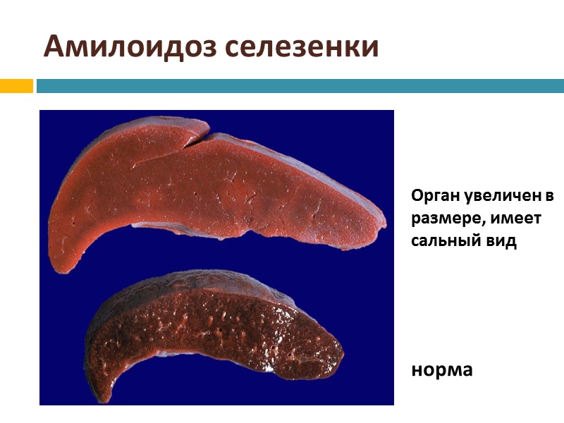 Строение органа на примере печени Паренхима – ткань, содержащая клетки, выполняющие специфические функции: гепатоциты