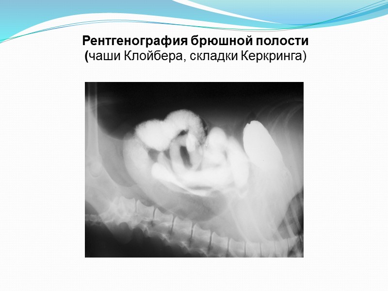 МСКТ орг.гр.кл. 15.07.2015г.  Заключение: Буллезная эмфизема легких. Хр.бронхит. Диффузный пневмосклероз. Ателектаз базальных сегментов