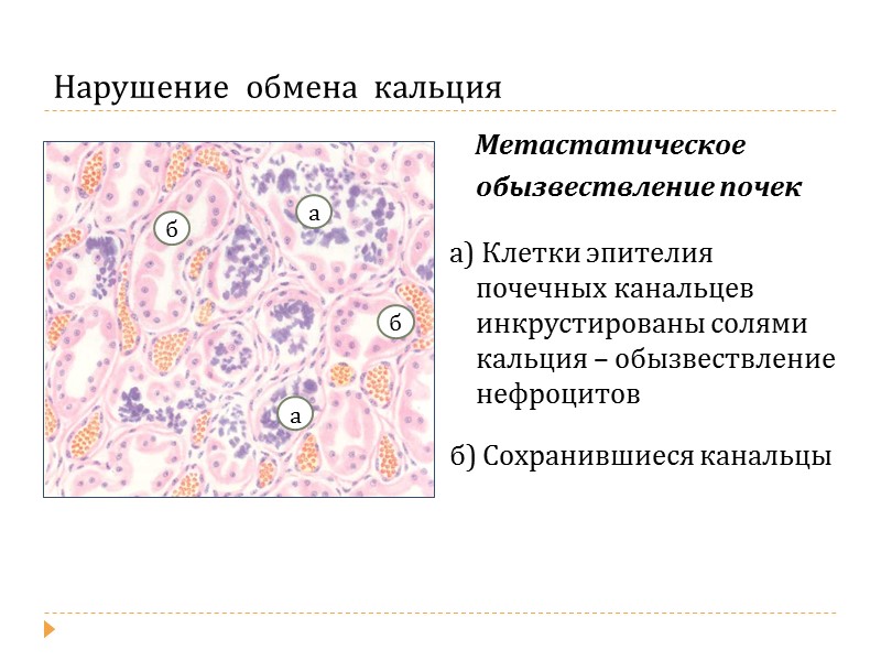 СМЕШАННЫЕ  ДИСТРОФИИ