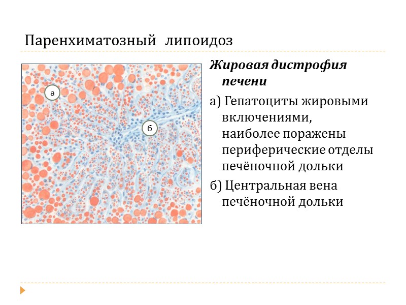 Жировая дистрофия печени картинки