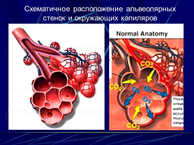 Системные заболевания,  при которых возникают ИБЛ: Рематические болезни: ревматоидный полиартрит, системная красная волчанка,