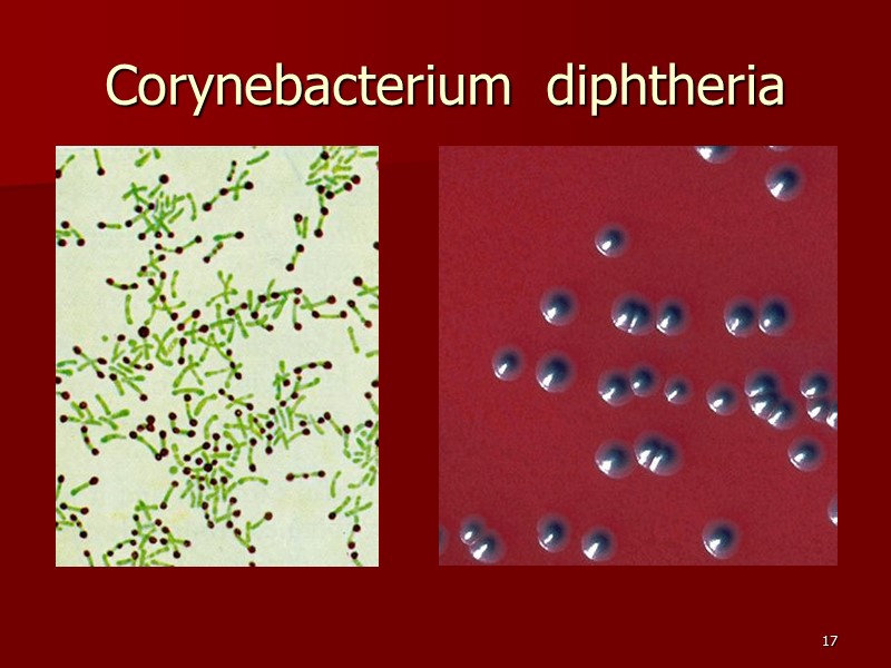 Возбудителя дифтерия возможна. Corynebacterium diphtheriae семейство. Коринебактериум дифтерия. Коринебактериум дефтерае. Коринебактерии дифтерии микробиология семейство.