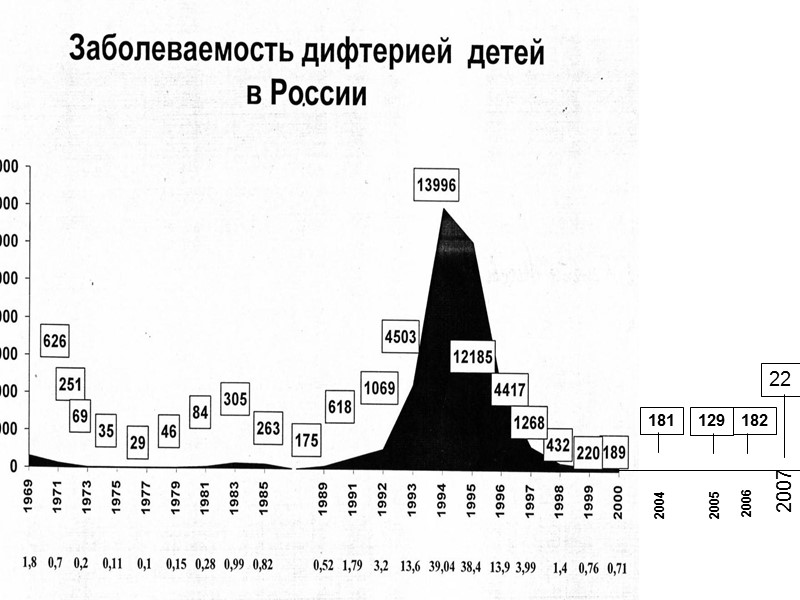 Дифтерия ротоглотки, распространённая форма Налет на миндалинах, дужках  и мягком небе Начало отторжения,