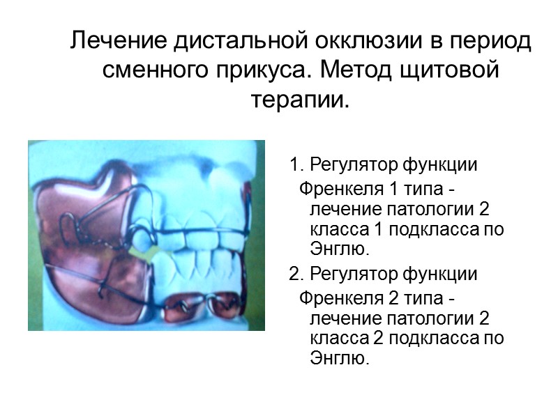 Дифдиагностика зубоальвеолярной и гнатической формы дистальной окклюзии.  Зубоальвеолярная форма: Размеры тела челюстей в