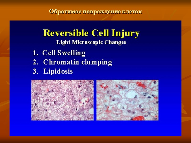 Повреждение клетки, связанное с ишемией и гипоксией Набухание органелл и клетки Активация анаэробного гликолиза,