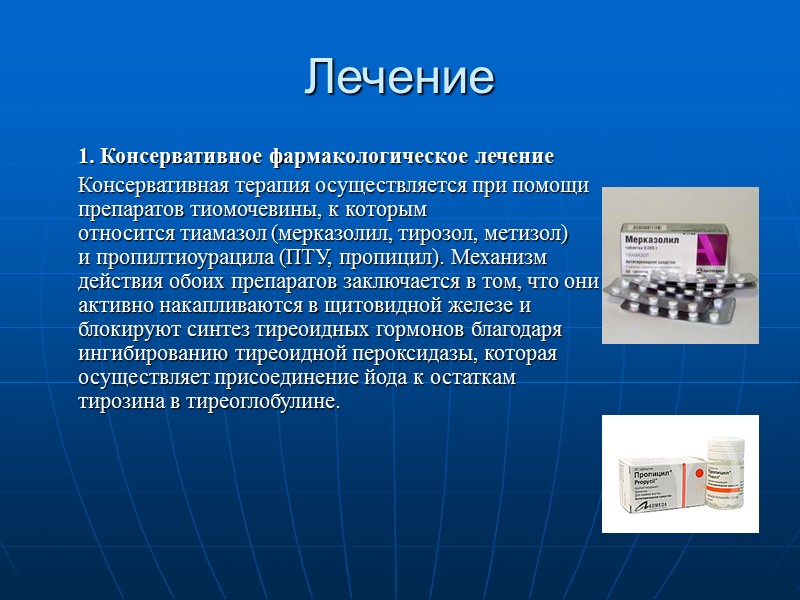 Классификация зоба по ВОЗ (1992)