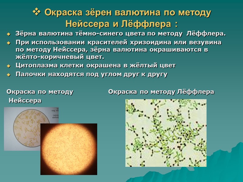 Лабораторная диагностика возбудителей дифтерийной инфекции  Основной метод диагностики – бактериологический, применяемый для выявления