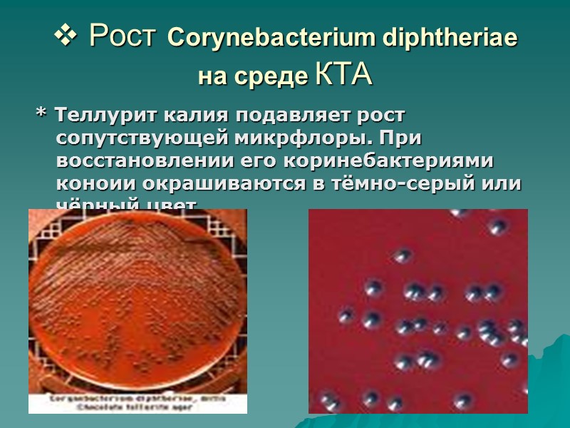 Возбудителя дифтерия возможна. Corynebacterium diphtheriae колонии. Corynebacterium diphtheriae микробиология. Рост коринобактерии дифтерии на среде Клауберга. Коринебактерии дифтерии на среде Клауберга.