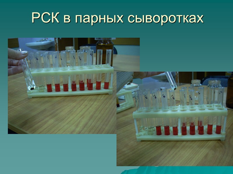 Реакция связывания комплемента микробиология. РСК С парными сыворотками микробиология. РСК В парных сыворотках. Реакция связывания комплемента РСК.