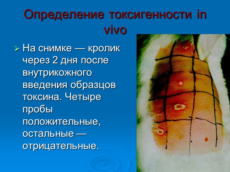 Дифтерия слизистой оболочки щеки слева