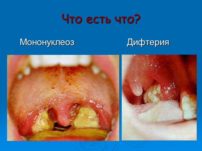 Определение токсигенности in vivo  На снимке — кролик через 2 дня после внутрикожного