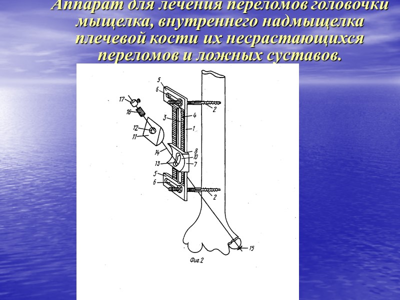 Введение базовых стержней