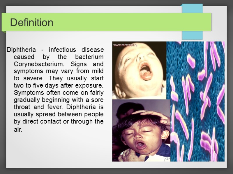 Definition Diphtheria - infectious disease caused by the bacterium Corynebacterium. Signs and symptoms may