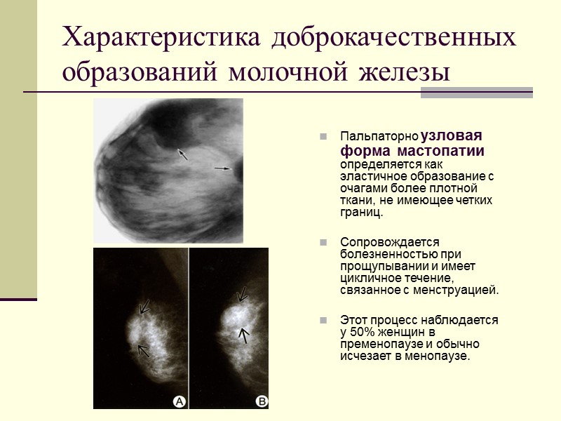 Рак молочной железы симптомы и признаки на ранних фото
