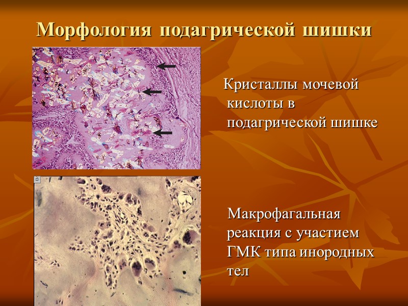 Протеиногенные (тирозиногенные) пигменты  Меланин Адренохром  Пигмент гранул энтерохромаффинных клеток Пигмент охроноза