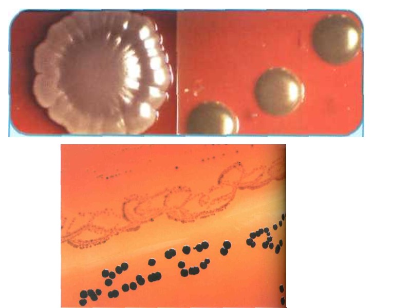 У истинно дифтерийной палочки - на полюсах клеток локализуются метахроматические зёрна волютина, придавая клеткам