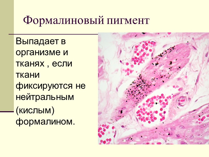 Виды желтух по механизму развития:  гемолитическая (надпечёночная); паренхиматозная (печёночная); механическая (подпечёночная).