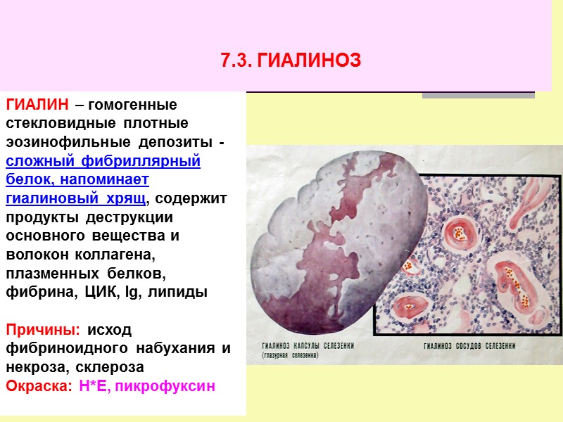 МЕТОДЫ ОКРАСКИ ТКАНИ  Основное вещество (гликозаминогликаны, белки и полисахариды плазмы крови)  