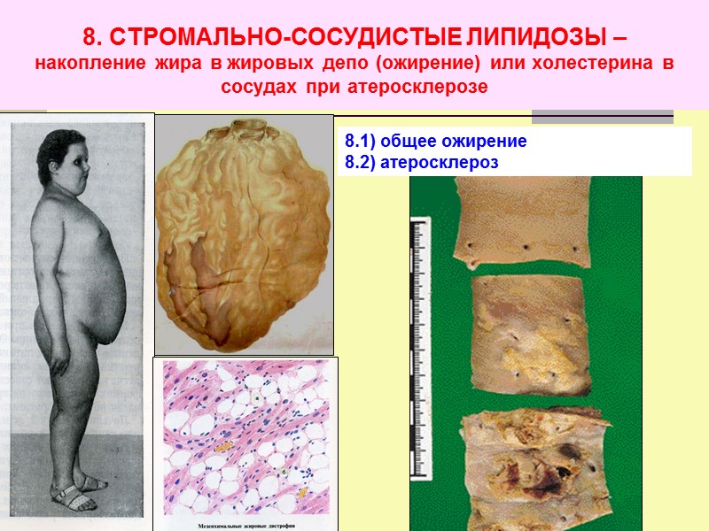 1-ая стадия  САГОВАЯ СЕЛЕЗЕНКА   Конго красный