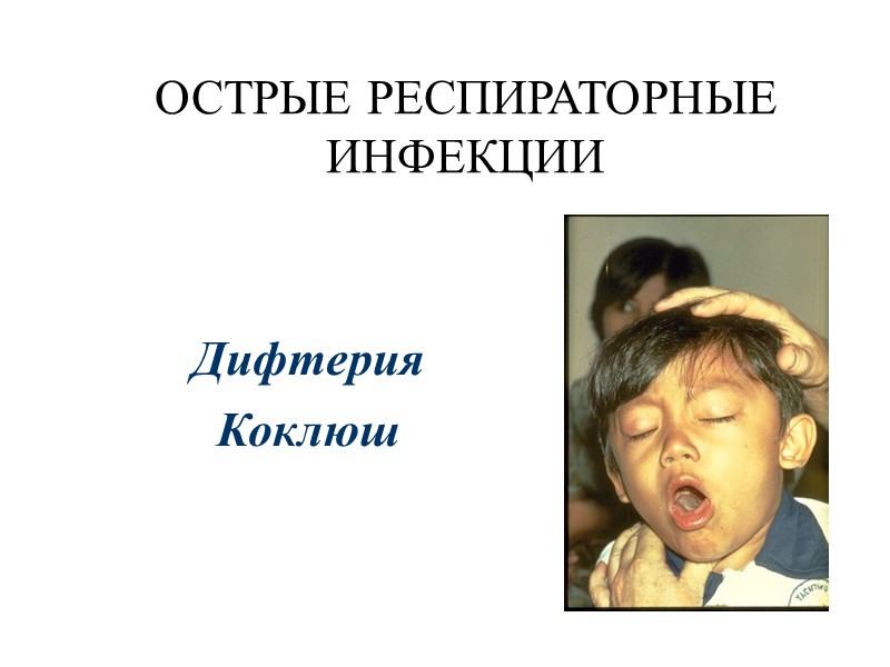 Род Corynebacterium включает:  по Берджи гр.20–  Гр+ неспорообразующие пал-ки неправильной формы 