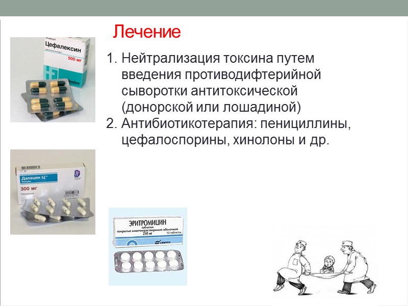 Классификация дифтерии Дифтерия ротоглотки Дифтерия носоглотки Дифтерия носа Дифтерия дыхательных путей (дифтерийный круп) Дифтерия