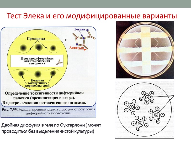 Эпидемиология Источник – больной или бактерионоситель Входные ворота инфекции – слизистые оболочки ротоглотки, носоглотки,