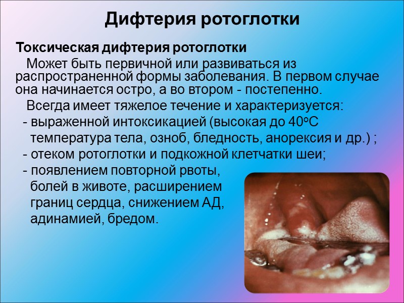 Источник инфекции:   больной человек;   реконвалесценты;  здоровый человек, являющийся носителем