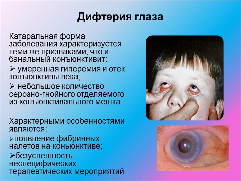 Клинические формы:  дифтерия ротоглотки;  гортани;  носа;  глаз;  редкой локализации:
