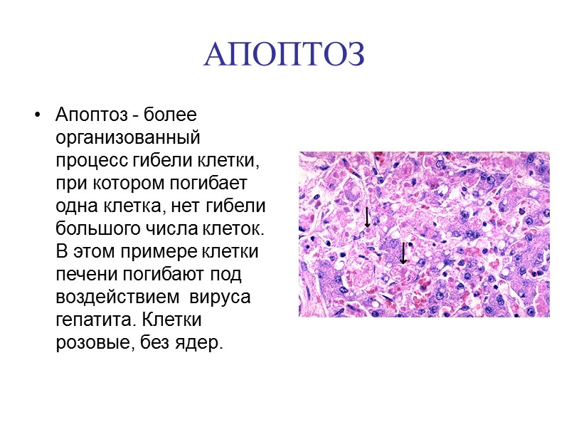 АПОПТОЗ Апоптоз — это генетически запрограммированная смерть клеток в живом организме. Некроз и апоптоз