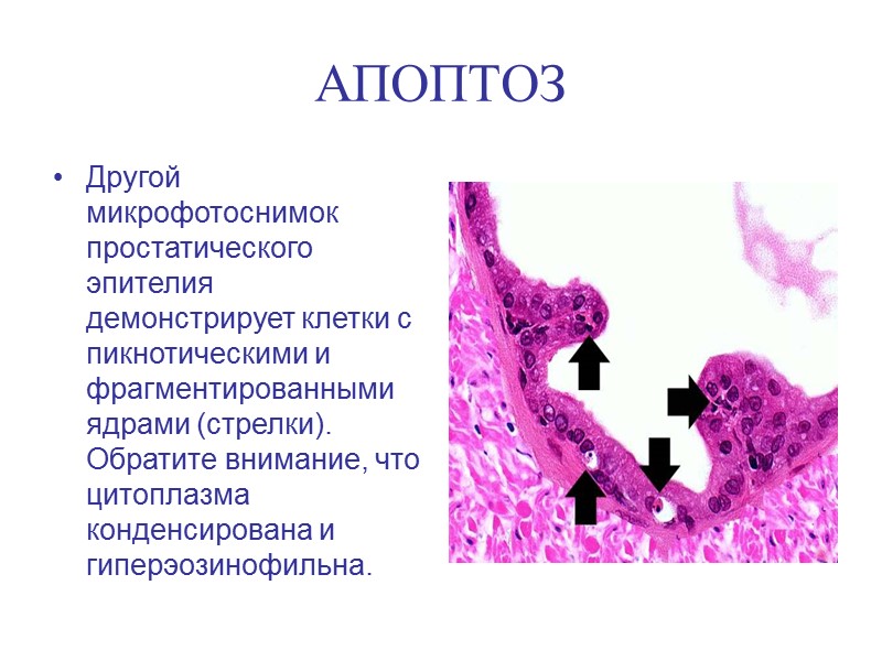 АПОПТОЗ Апоптоз - более организованный процесс гибели клетки, при котором погибает одна клетка, нет