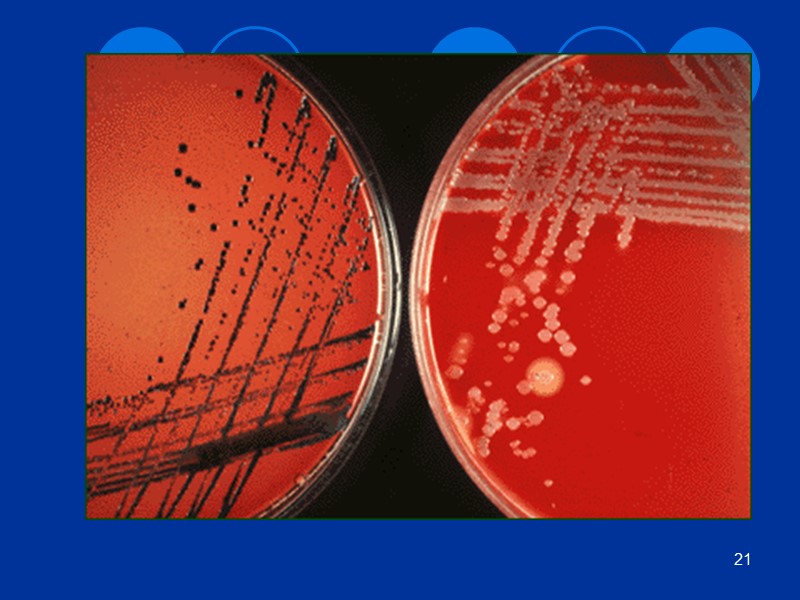 Иммунитет при дифтерии Естественный Зависит от возраста. Чаще болеют восприимчивые дети до 5 лет.